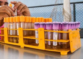 Prefeitura de Cruzeiro do Sul adquire  mais testes da covid-19