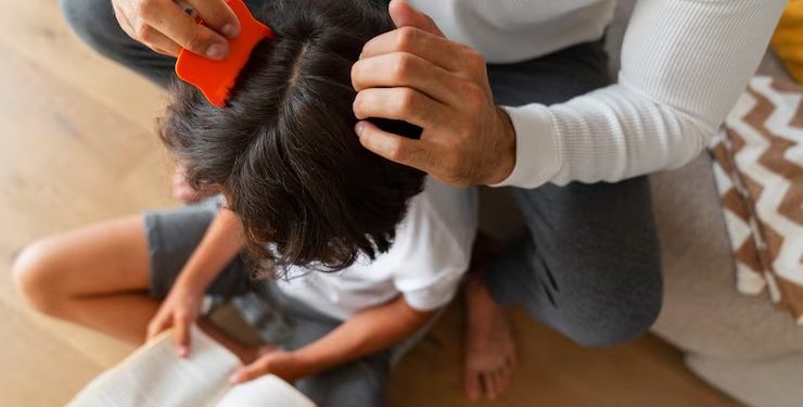 Especialista explica as opções de tratamento para eliminar os piolhos