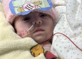 Menina Aurora mostra sinais de recuperação após enxerto complexo e inspira onda de solidariedade