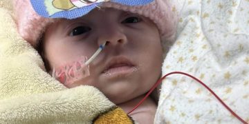 Menina Aurora mostra sinais de recuperação após enxerto complexo e inspira onda de solidariedade